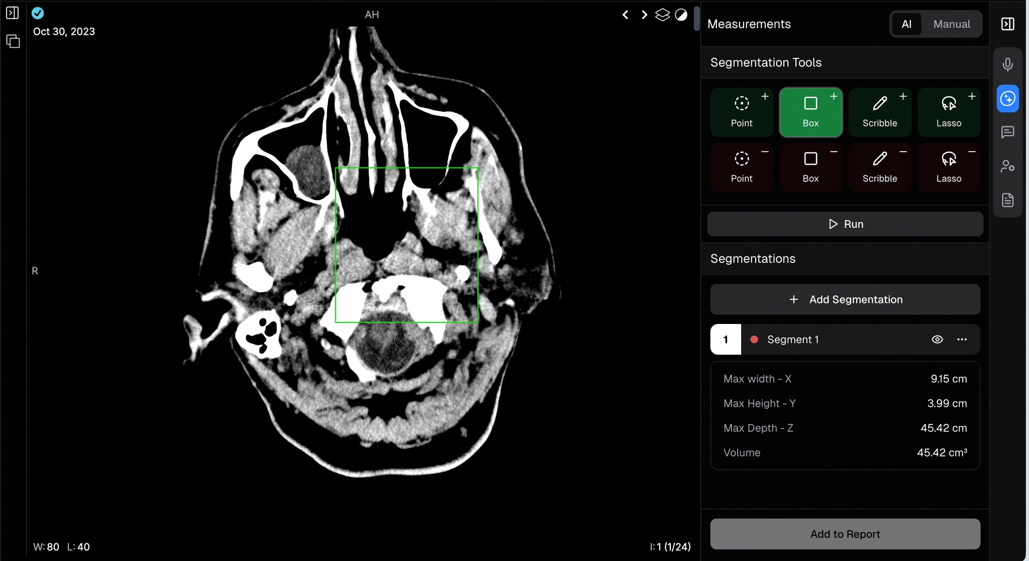 AI Measurements - draw overlay