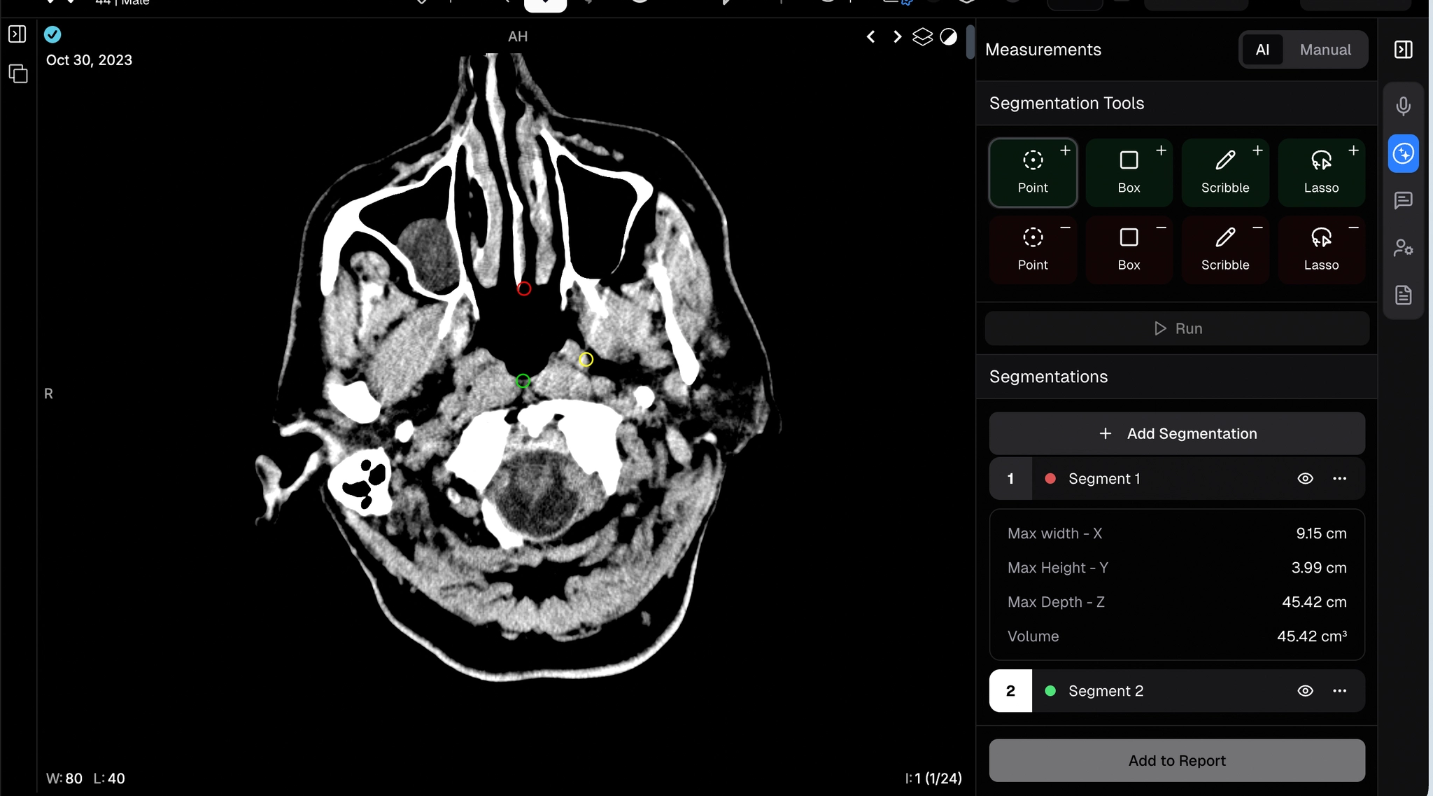 AI Measurements - overlay with metrics