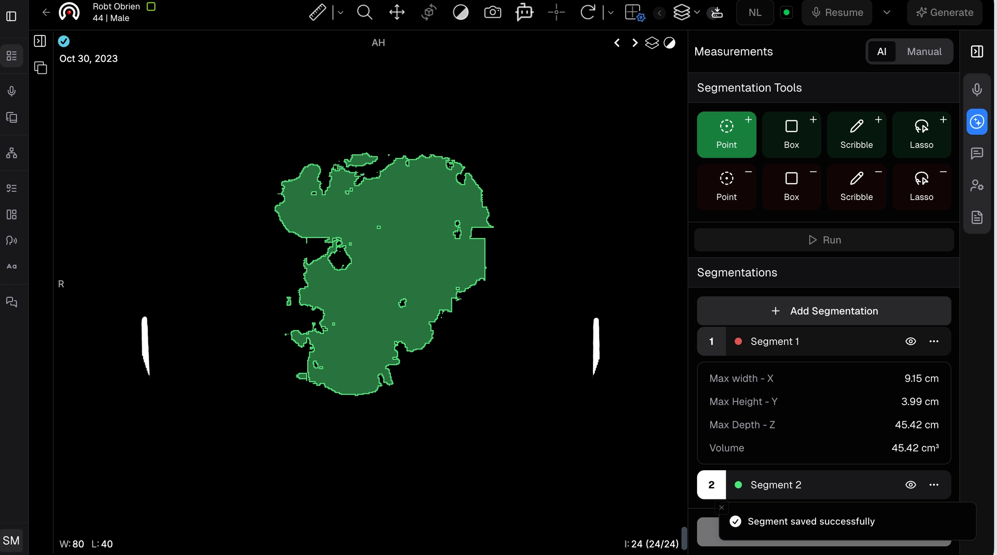 AI Measurements - add segmentation
