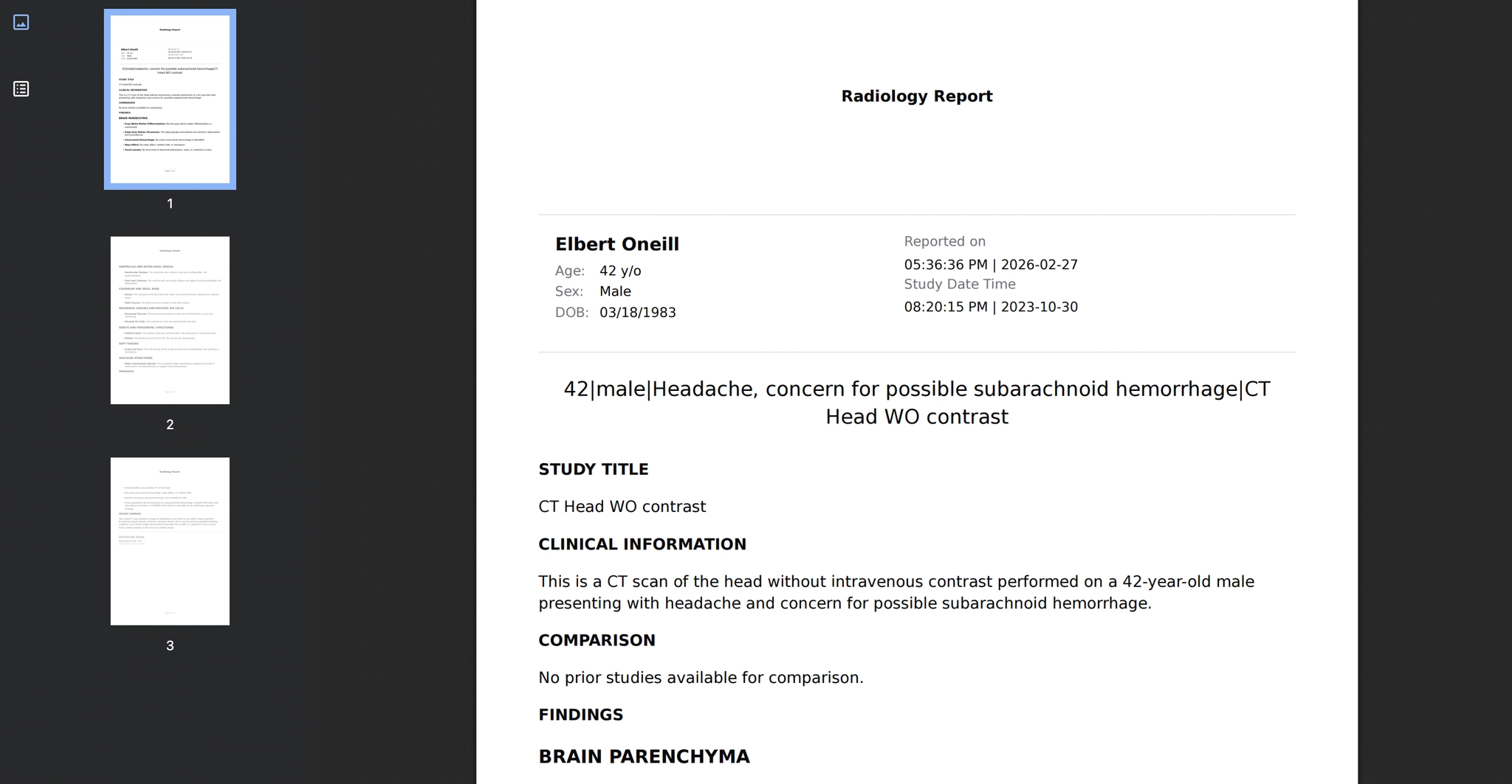 Download complete