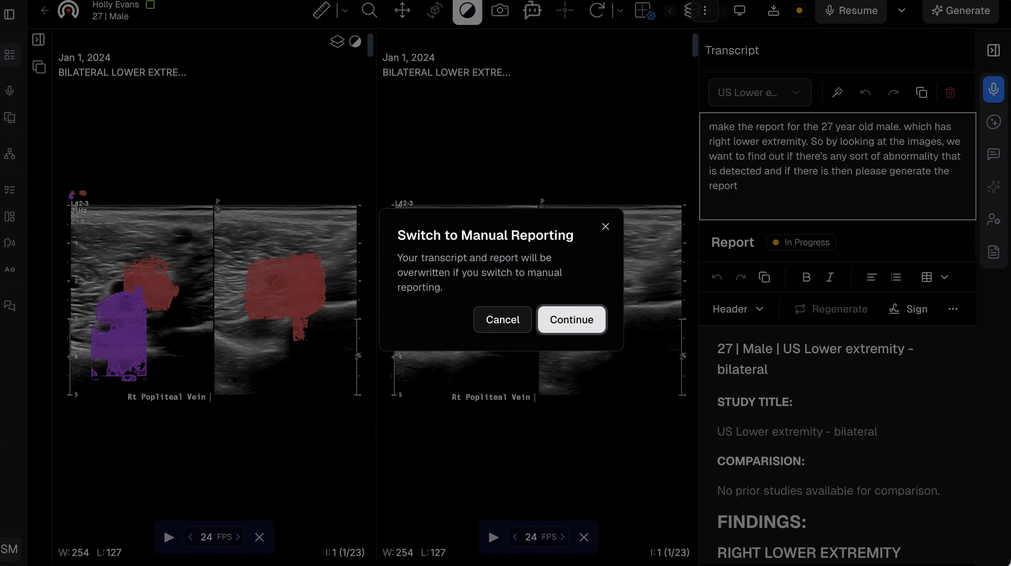Manual reporting - workstation view