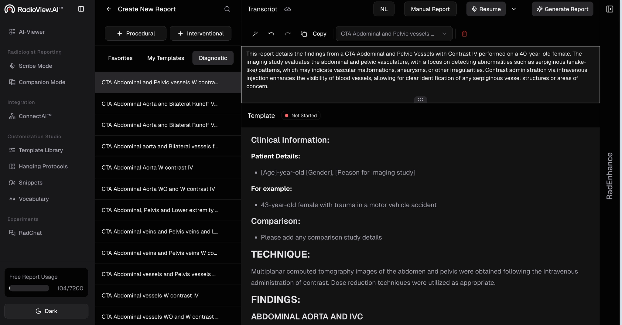 Custom terms recognized in transcript